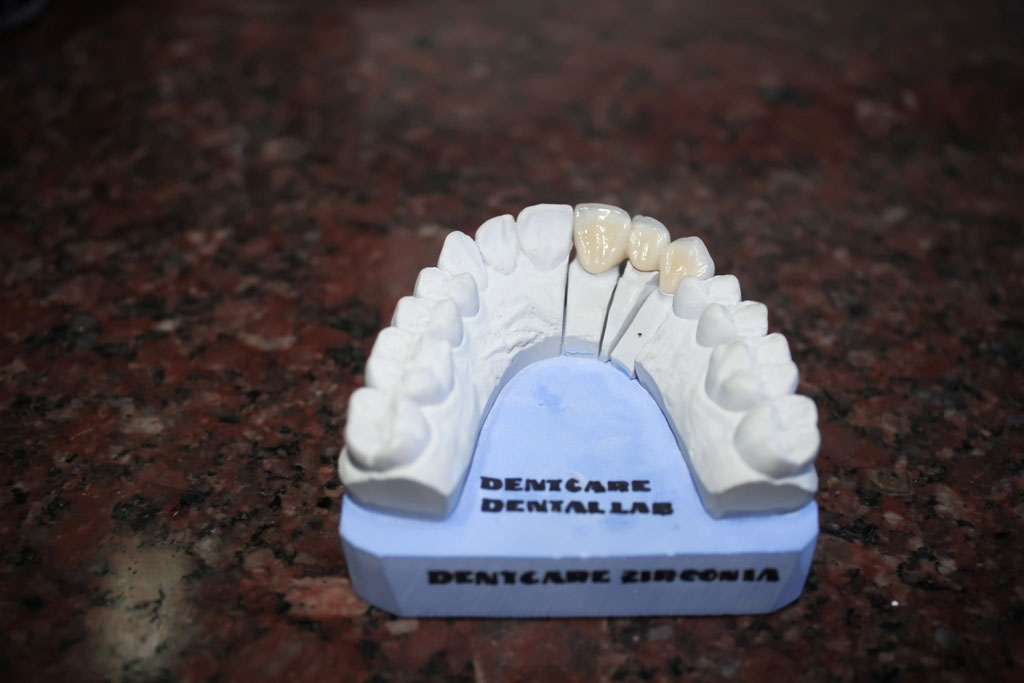 Dental tourism india